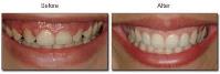 Open Late Dentistry and Orthodontics image 5